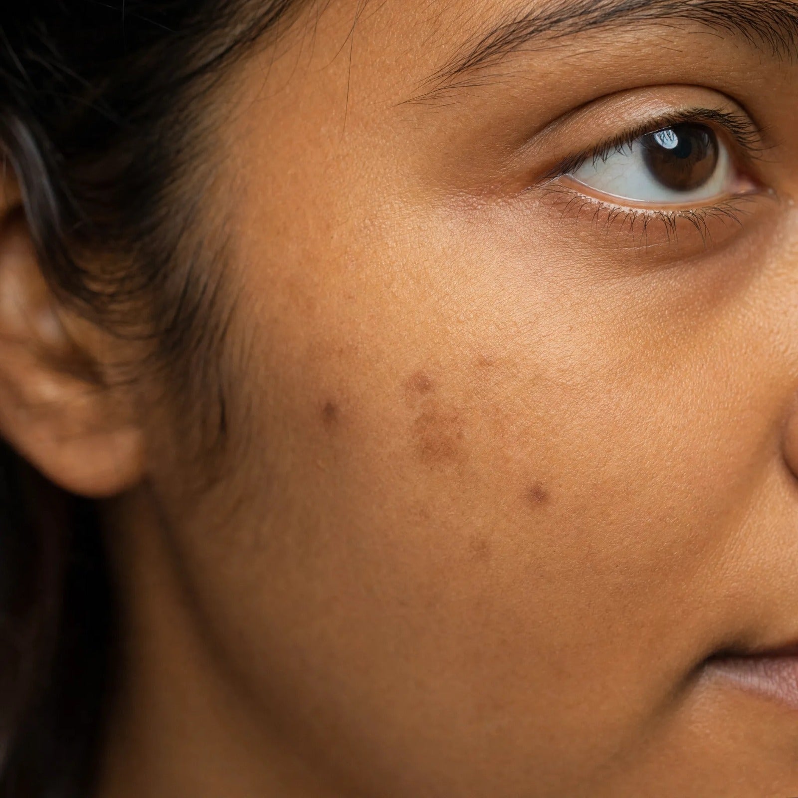 Dark spots